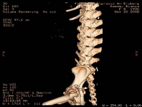 Mein Hund hat Arthrose> Goldinlays ??? Gesundheit DogForum.de das